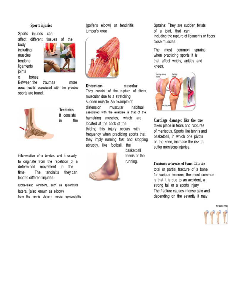 Understanding Common Sports Injuries | PDF | Knee | Musculoskeletal ...