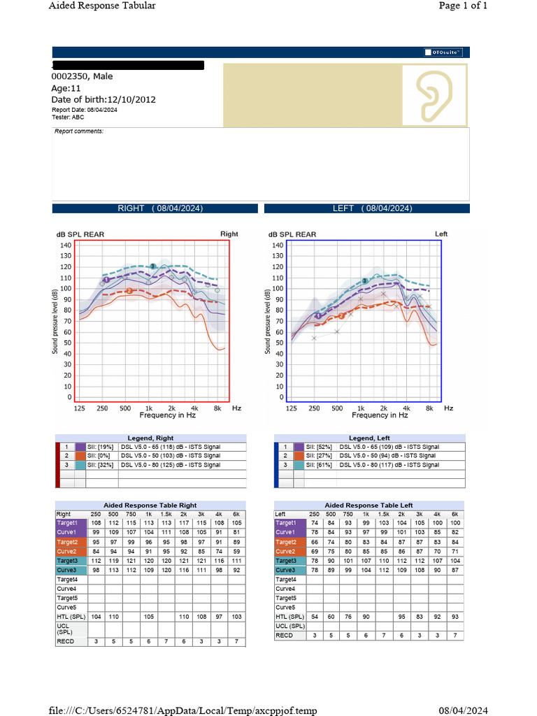 Mms | PDF | Sound | Acoustics