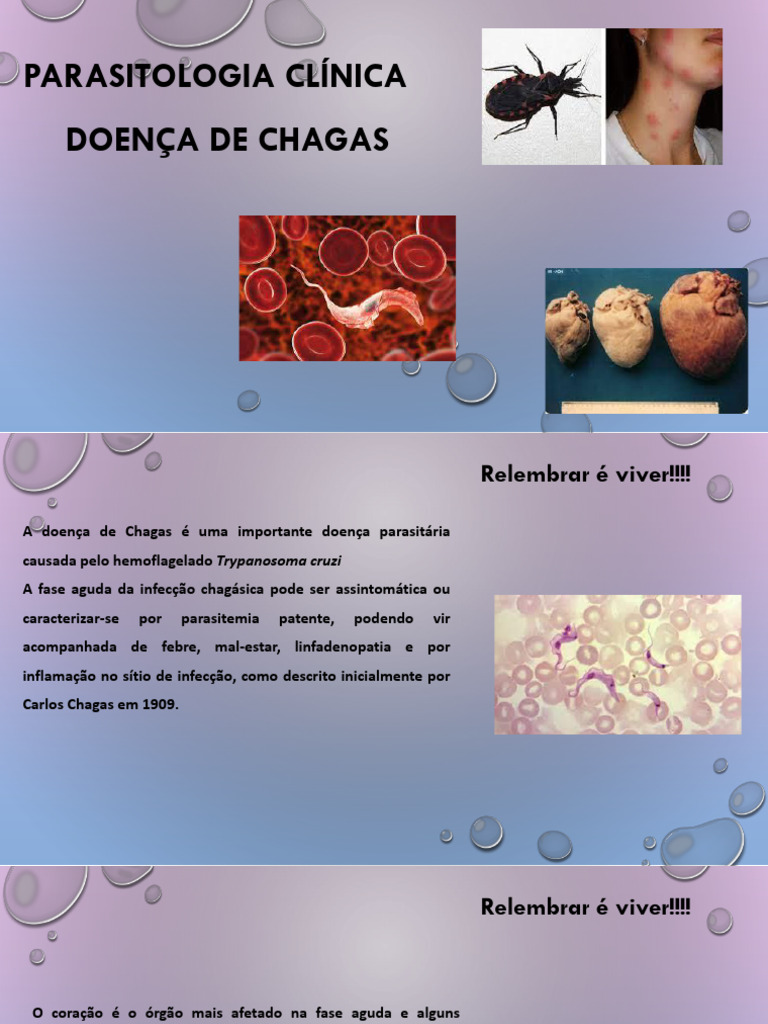Aula 6 - Doença de Chagas | PDF | Antígeno | Inflamação