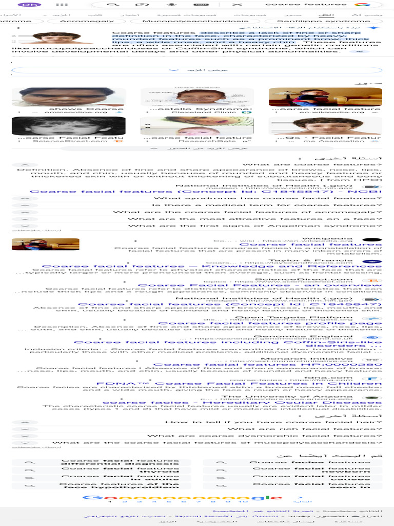 Understanding Coarse Facial Features | PDF | Diseases And Disorders ...