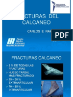 Fracturas Del Calcaneo