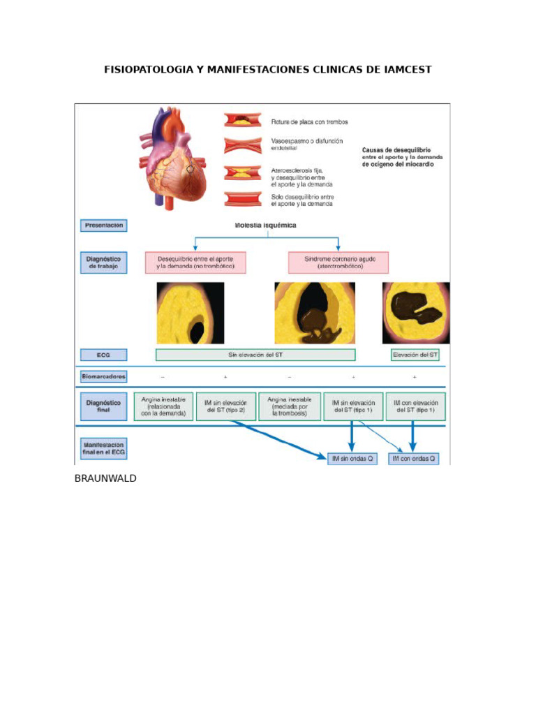 Fisiopatología del Infarto de Miocardio | PDF | Endothelium | Macrophage