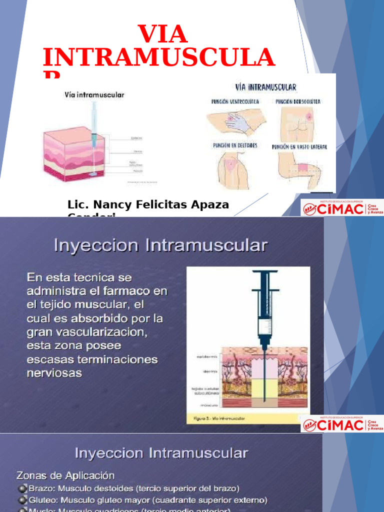 Inyecciones Intramusculares: Guía de Zonas | PDF