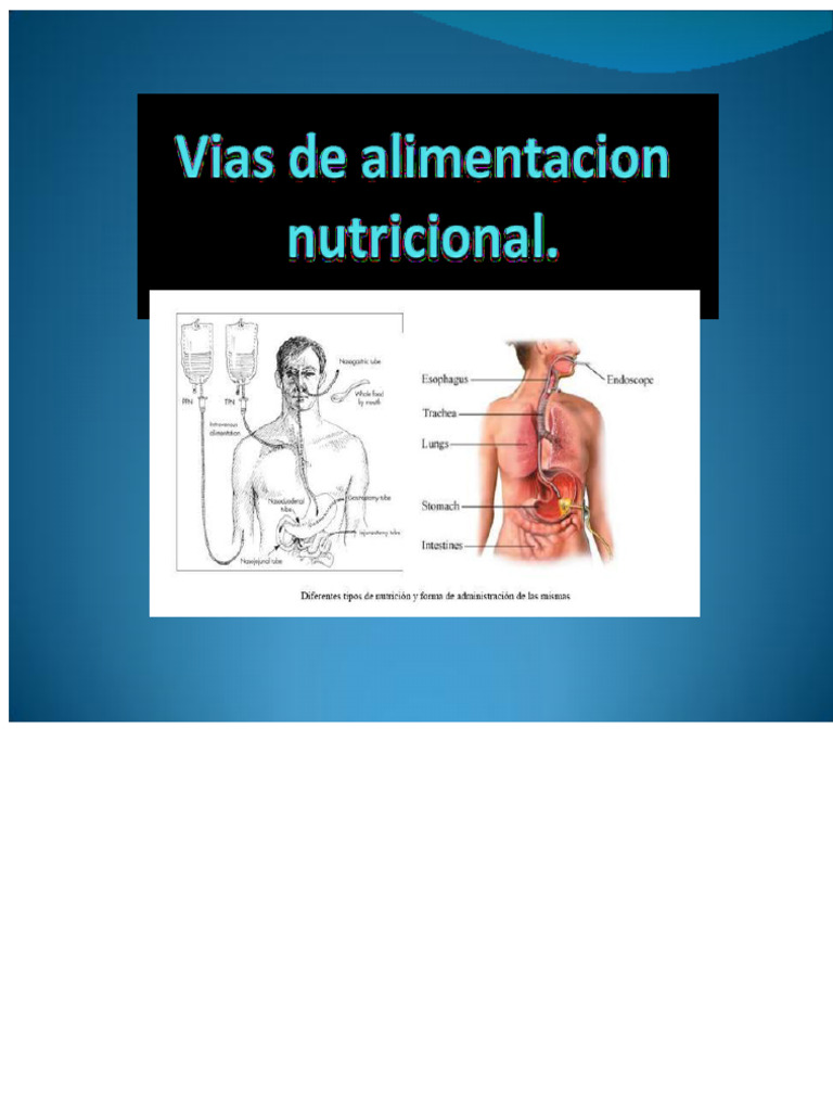 Nutritional Feeding Routes | PDF | Medical Specialties | Gastroenterology