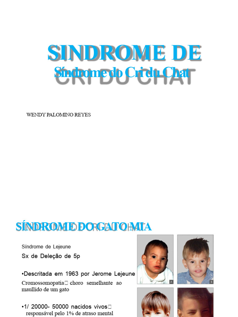 Síndrome do Cri du Chat: Causas e Tratamento | PDF