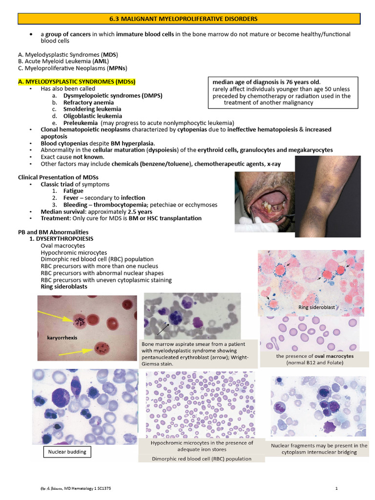 Myelodysplastic Syndromes Overview | PDF | White Blood Cell | Tissue ...