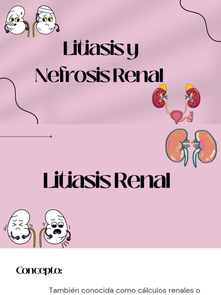 Litiasis y Nefrosis Renal: Síntomas y Tratamientos | PDF ...