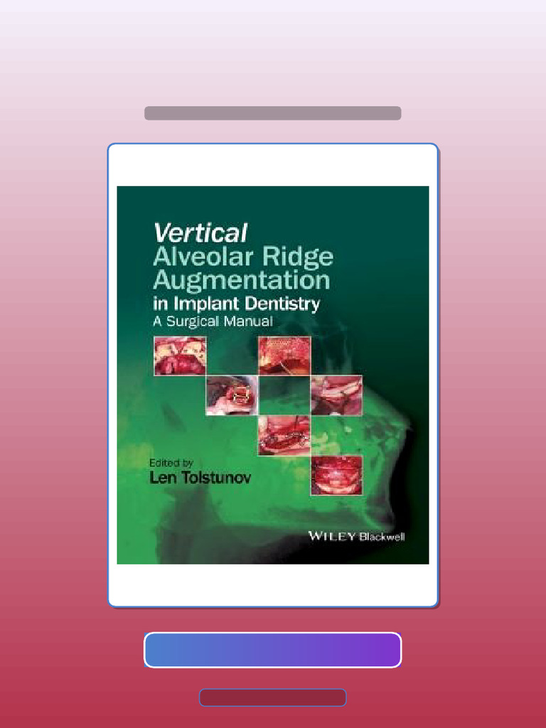 Vertical Alveolar Ridge Augmentation in Implant Dentistry Ebook and ...
