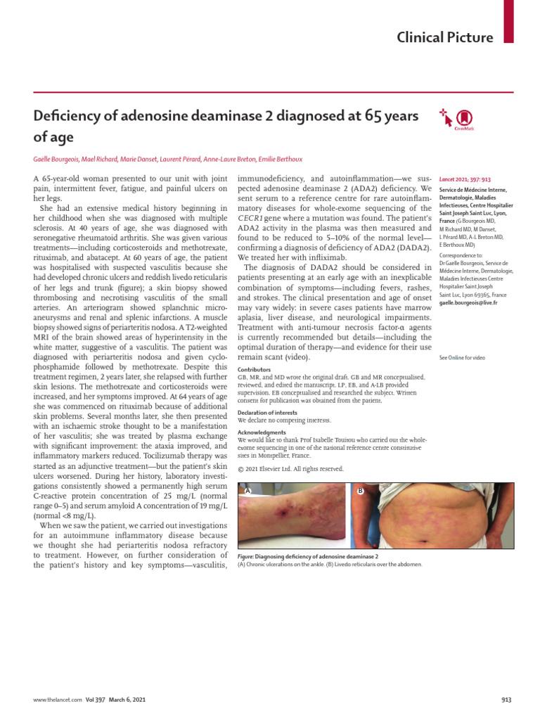 Deficiency of Adenosine Deaminase 2 Diagnosed at 6 | PDF | Diseases And ...