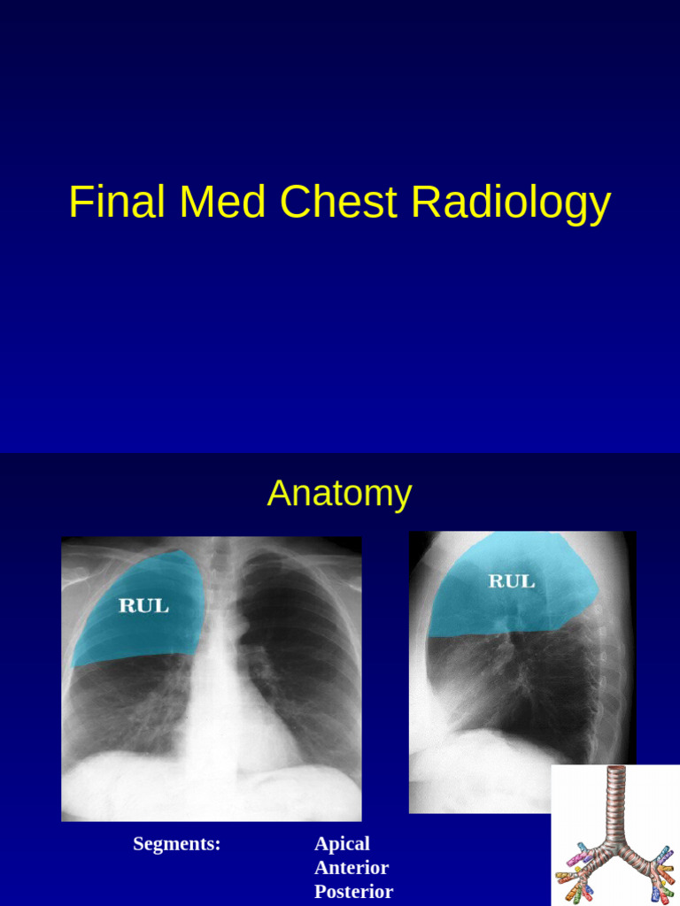 Final Med Chest Radiology | PDF | Lung | Thorax