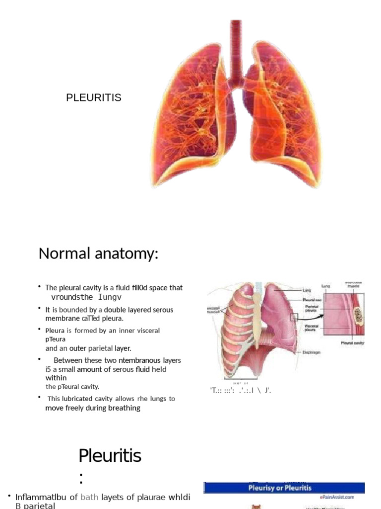 Understanding Pleuritis Symptoms & Treatment | PDF