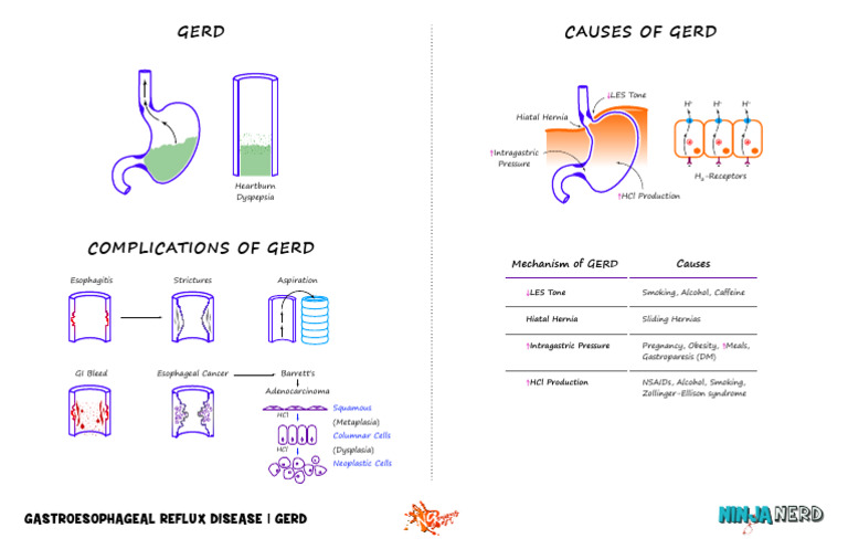 Understanding GERD: Causes and Complications | PDF | Gastroesophageal ...