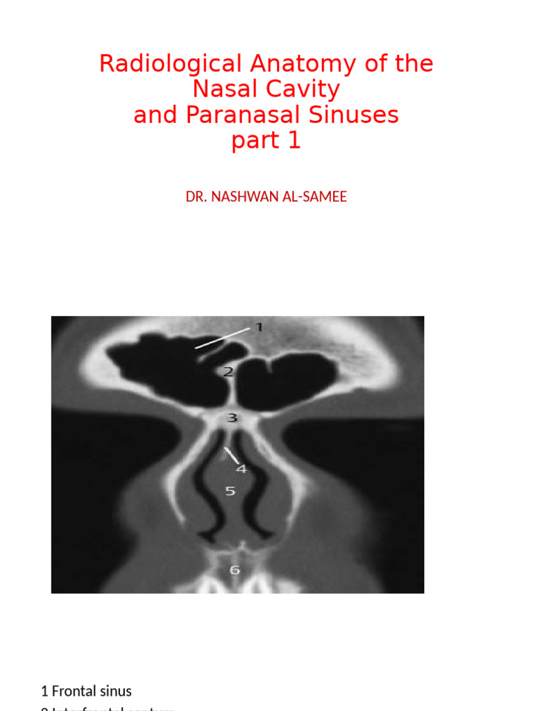 Nasal Cavity & Sinuses Anatomy Guide | PDF | Human Nose | Human Head ...