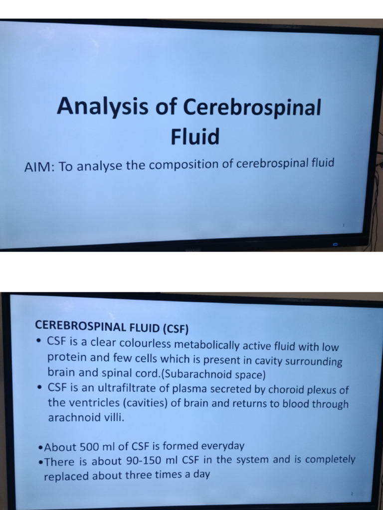 Cerebrospinal Fluid (Biochem) | PDF