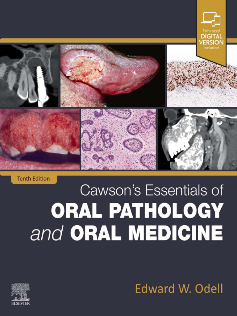 Accessing Cawson's Oral Pathology eBook | PDF | Human Tooth ...