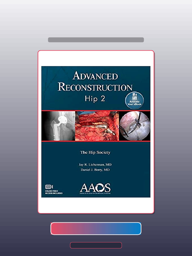 Test Bank for Advanced Reconstruction Hip 2 | PDF | Surgery
