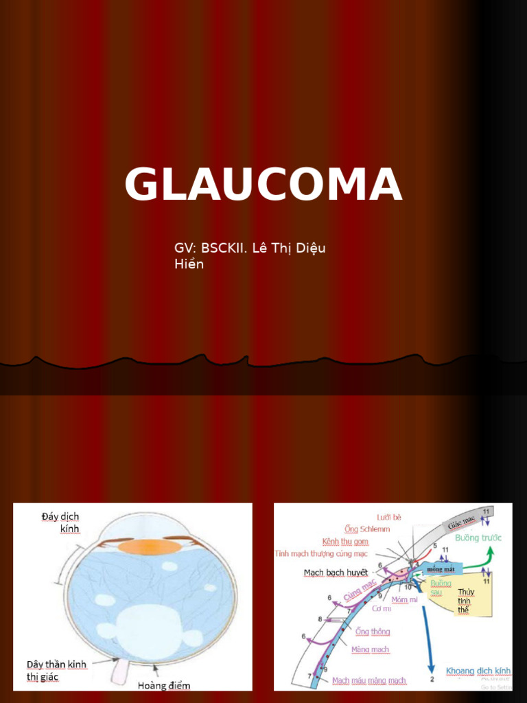 3.2. Glaucoma Final | PDF