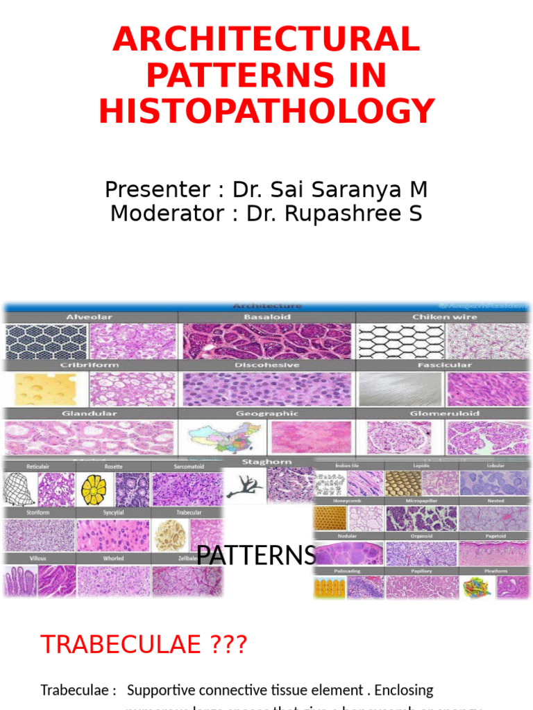 Histopathology Architectural Patterns | PDF | Epithelium | Neoplasms