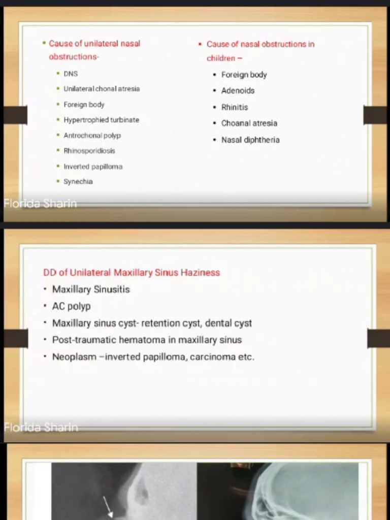 XRAY in ENT 2 | PDF