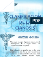 Semio Expo Grupo 7. - Cianosis Clasificacion