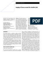 Imaging of Bursae Around The Shoulder Joint: Nathalie J. Bureau Robert G. Dussault Theodore E. Keats