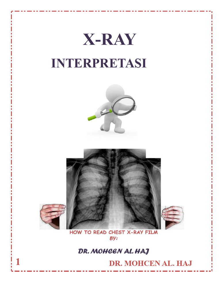 Panduan Lengkap Rontgen Dada | PDF