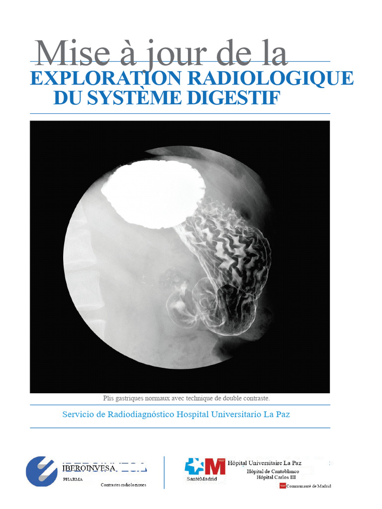 Exploration radiologique de l'appareil digestif | PDF | Appareil digestif