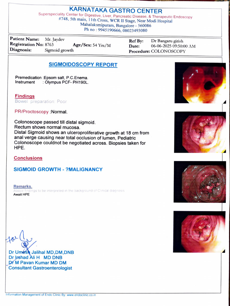 Sigmoid Growth Colonoscopy Report | PDF