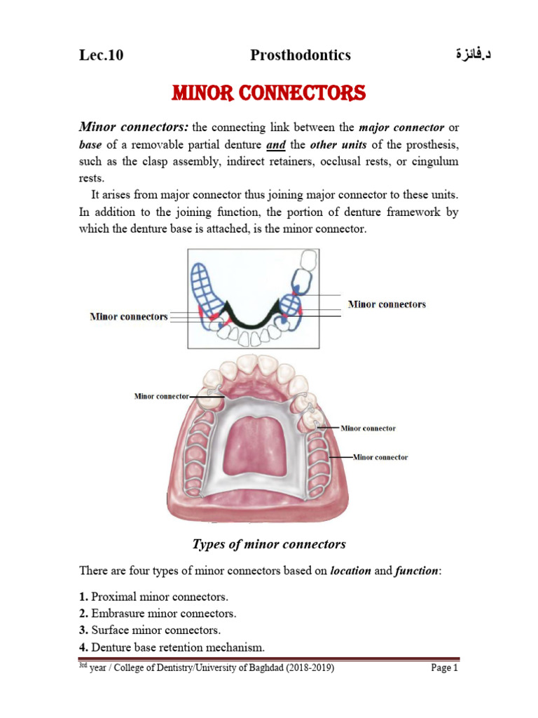 Types and Functions of Minor Connectors | PDF | Dentures | Dentistry