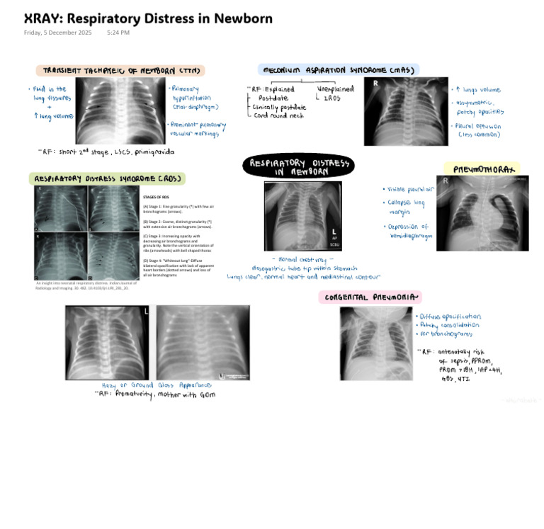 Stages of Neonatal Respiratory Distress | PDF