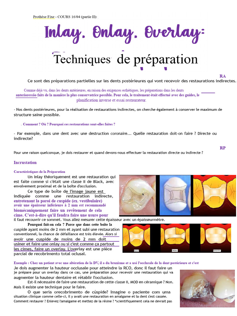 Préparations dentaires pour restaurations indirectes | PDF | Friction ...