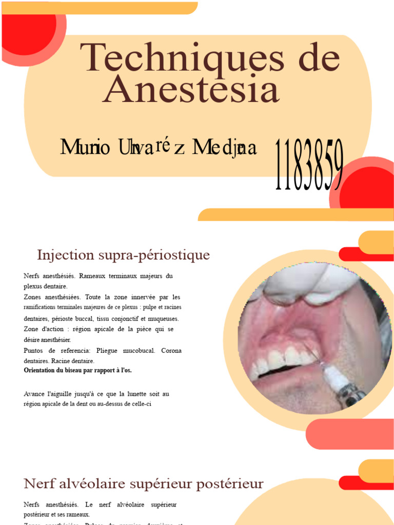Techniques d'anesthésie dentaire maxillaire PDF Dent Bouche — free download