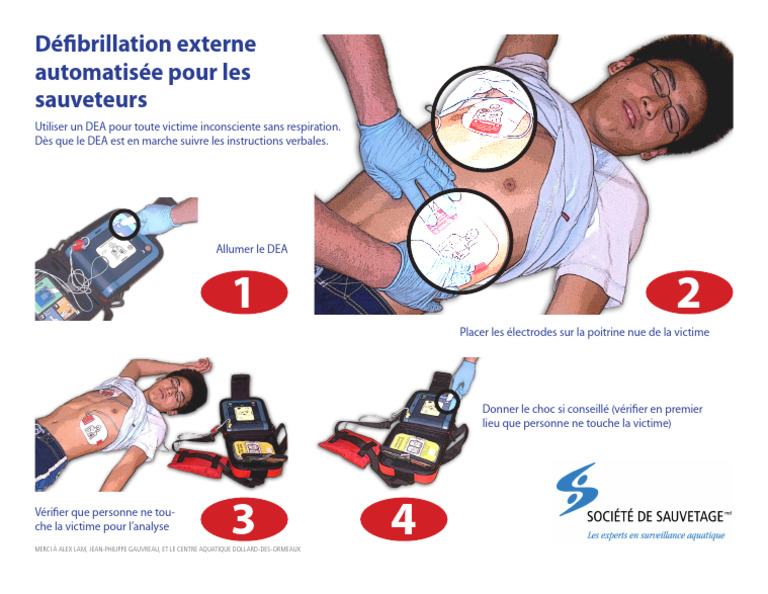 Guide d'utilisation du DEA pour sauveteurs | PDF