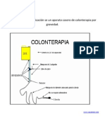 Colonterapia Casera