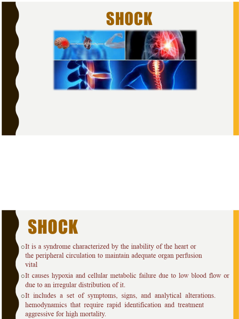 Shock | PDF
