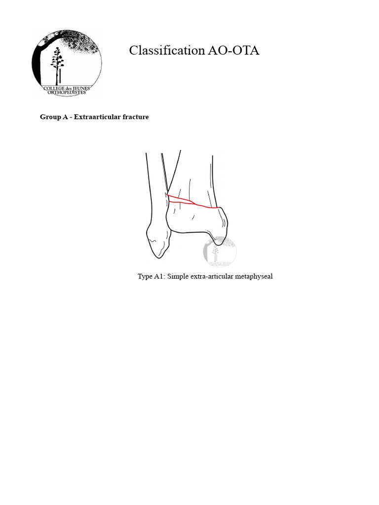 Classification Ao Ota Fract | PDF