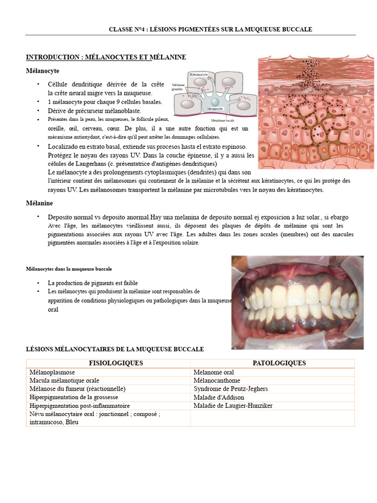 Lésions pigmentées de la muqueuse buccale | PDF | Mélanome