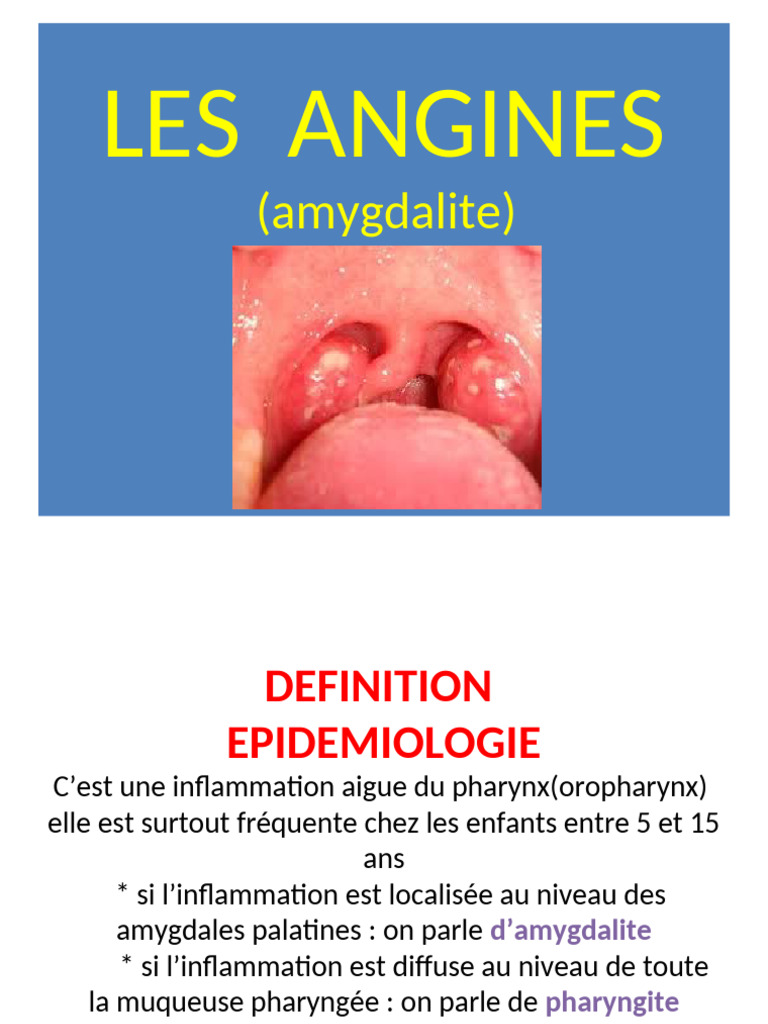 Angines : symptômes, causes et traitements | PDF | Immunologie ...