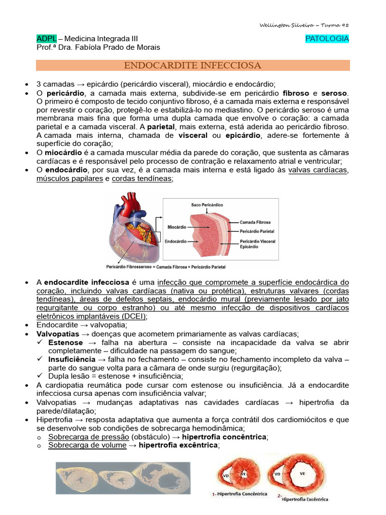 Endocardite Infecciosa: Causas e Sintomas | PDF | Coração ...