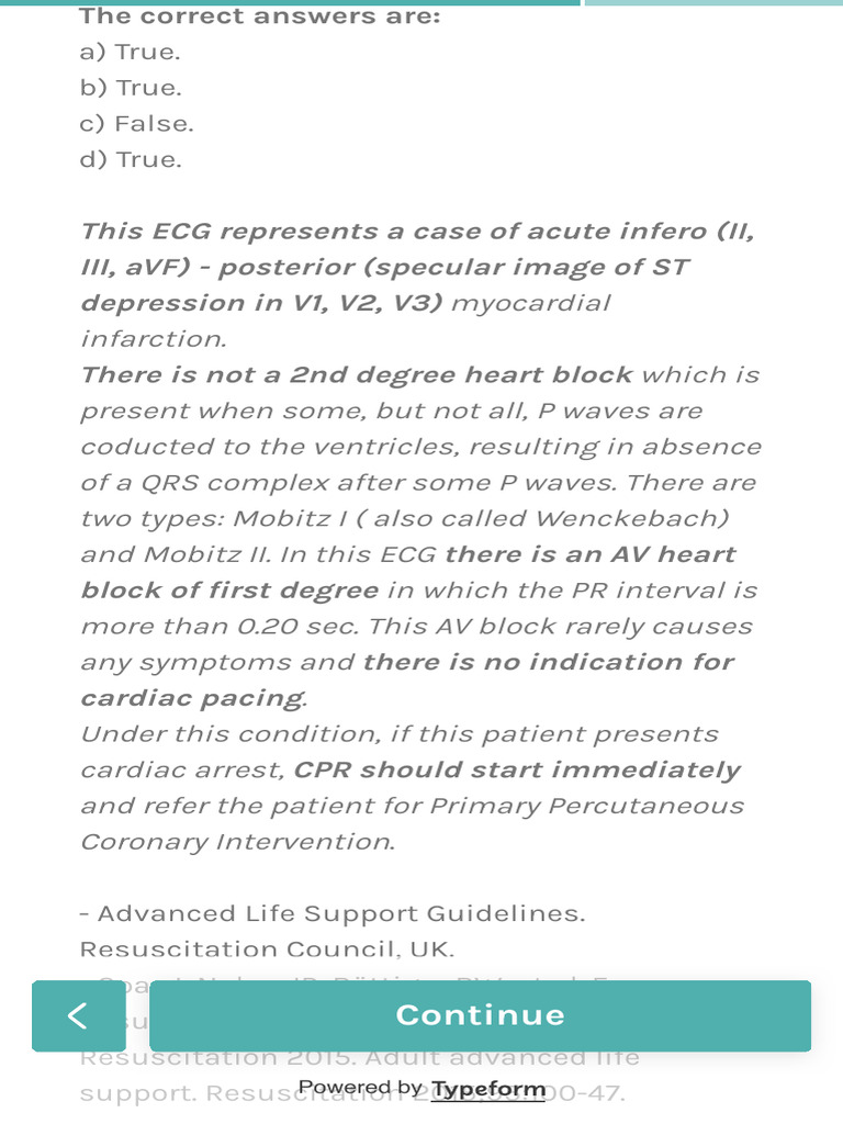 ECG Analysis: Myocardial Infarction Insights | PDF