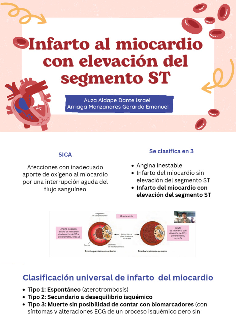 Expo CARDIOLOGIA IMCEST Terminada | PDF | Infarto de miocardio ...