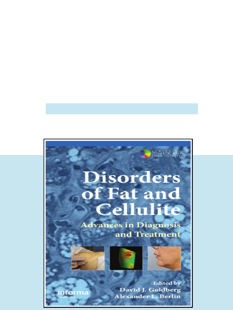 (Ebook) Disorders of Fat and Cellulite: Advances in Diagnosis and ...