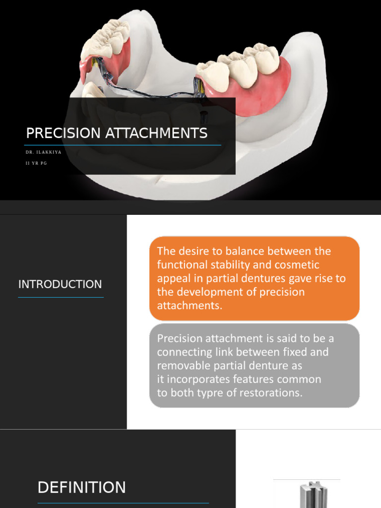 Precision Attachments in Dentistry Guide | PDF | Dentures | Tooth