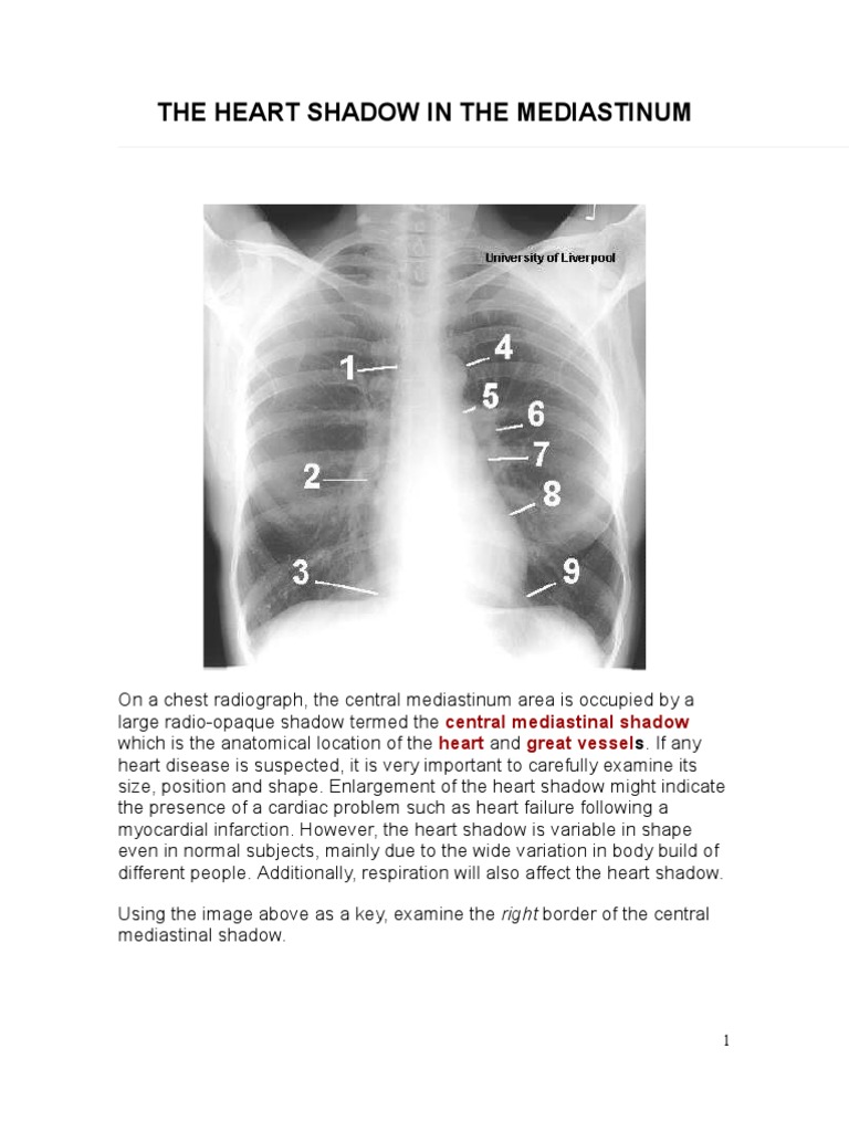 The Heart Shadow in The Mediatinum | PDF | Aorta | Heart