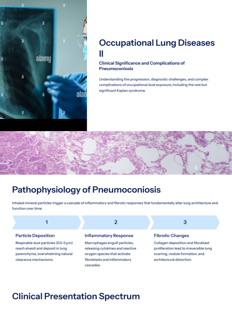Clinical Insights on Pneumoconiosis | PDF | Rheumatoid Arthritis | Lung