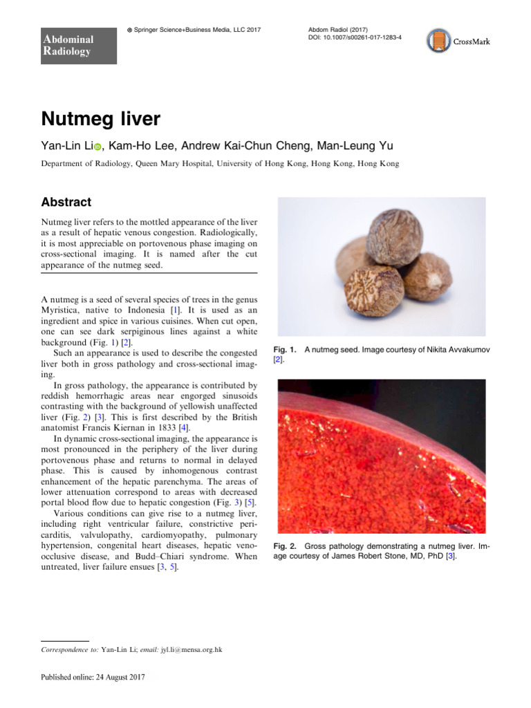 Nutmeg Liver | PDF | Liver | Medical Specialties