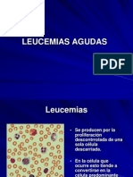 Leucemias Agudas