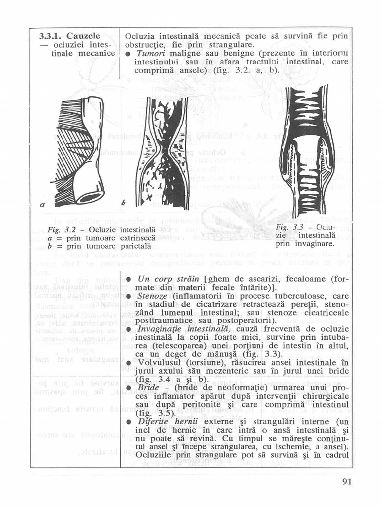 Ocluzia Intestinala Cauze Simtopome Conduita | PDF
