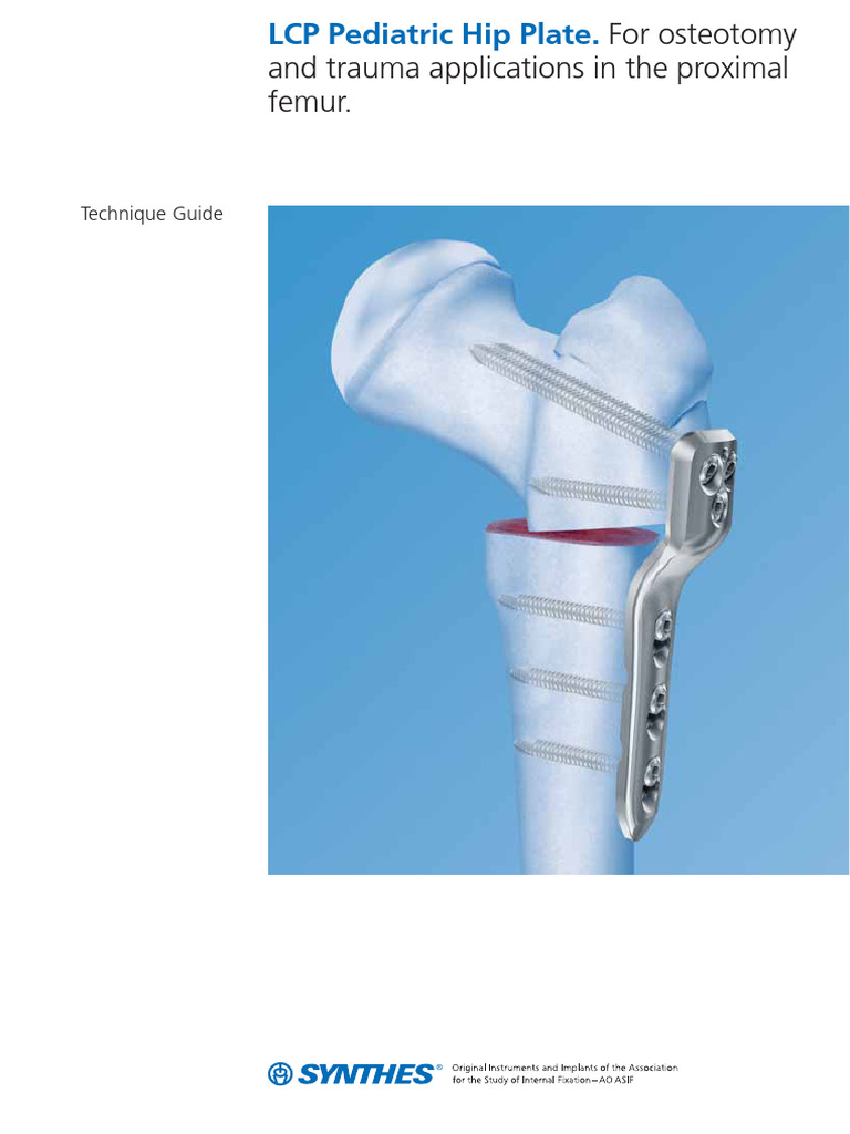 LCP Paed Hip Plate ST | PDF | Hip | Drill