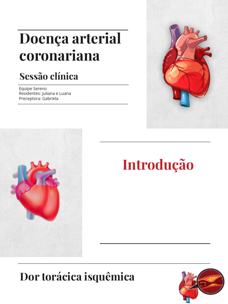 Avaliação e Tratamento da Doença Arterial Coronária | PDF | Infarto do ...